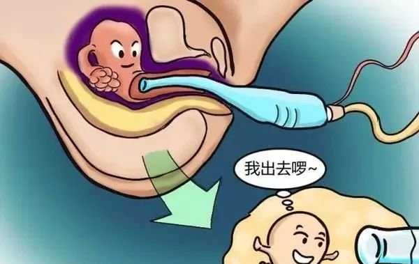 深圳市一助就孕_试管婴儿前准备工作详细，拿上你的小本本记好 